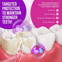 GuruNanda Anticavity Fluoride Mouthwash – Helps Prevent Cavities & Strengthen Teeth and Enamel – 0.05% Sodium Fluoride Therapeutic Oral Rinse – Alcohol-Free, Vibrant Mint, 16 oz
